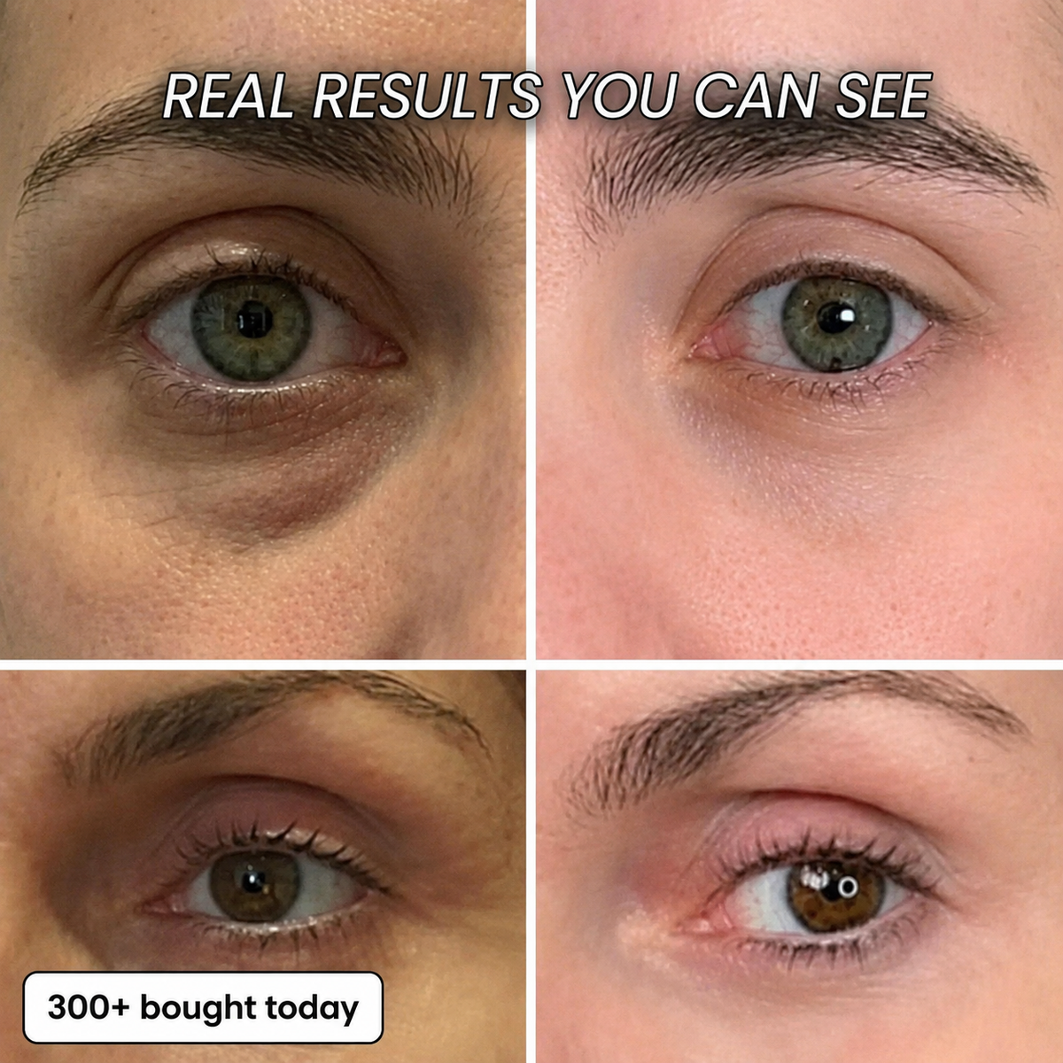 Real eye-area results