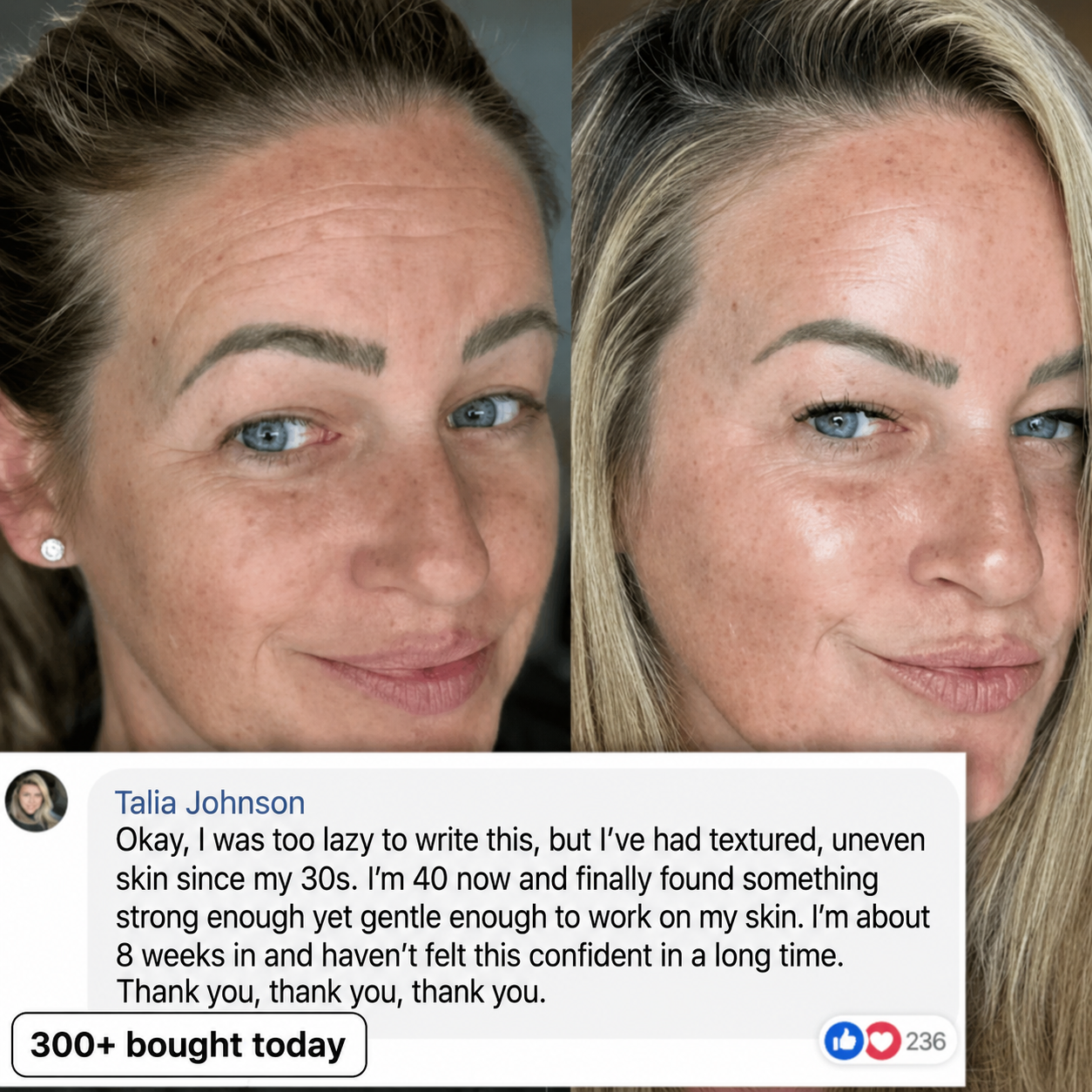Customer texture before and after result